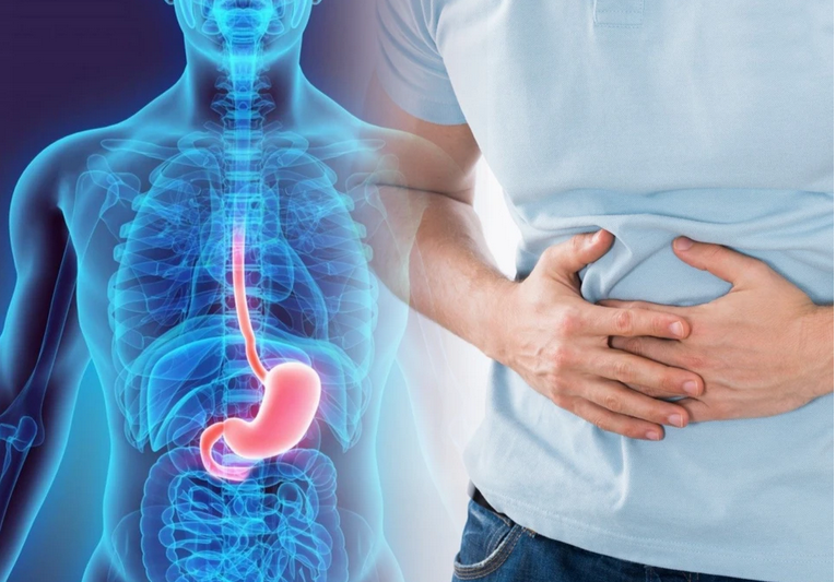 أعراض قرحة المعدة